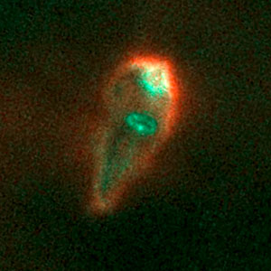 Proplyd in the Orion Nebula
