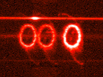 STIS chemically analyzes the ring around SN 1987a