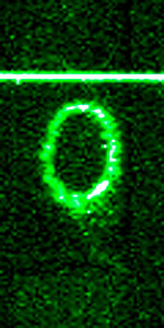 STIS chemically analyzes the ring around SN 1987a