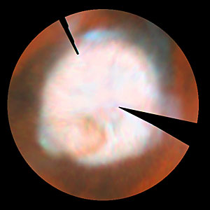 Seasonal Changes In Mars' North Polar Ice Cap