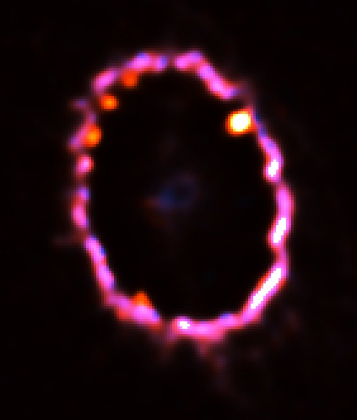 The Glowing Gas Ring around Supernova 1987A