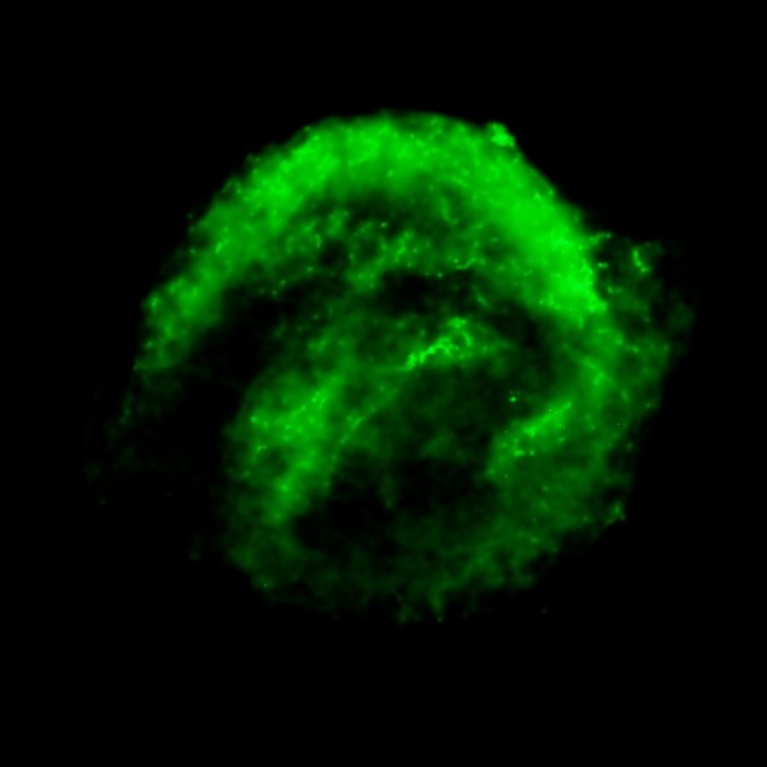 Chandra X-ray Observatory Data of Kepler's Supernova Remnant