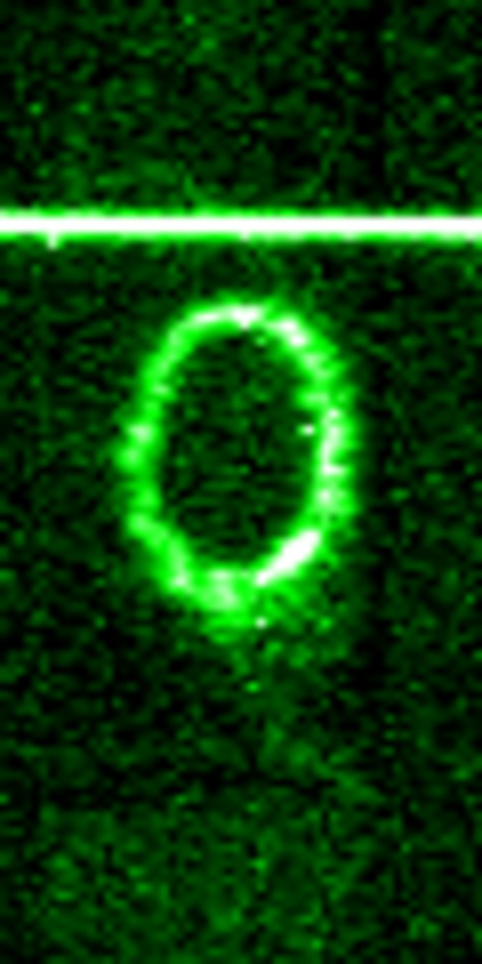 STIS chemically analyzes the ring around SN 1987a